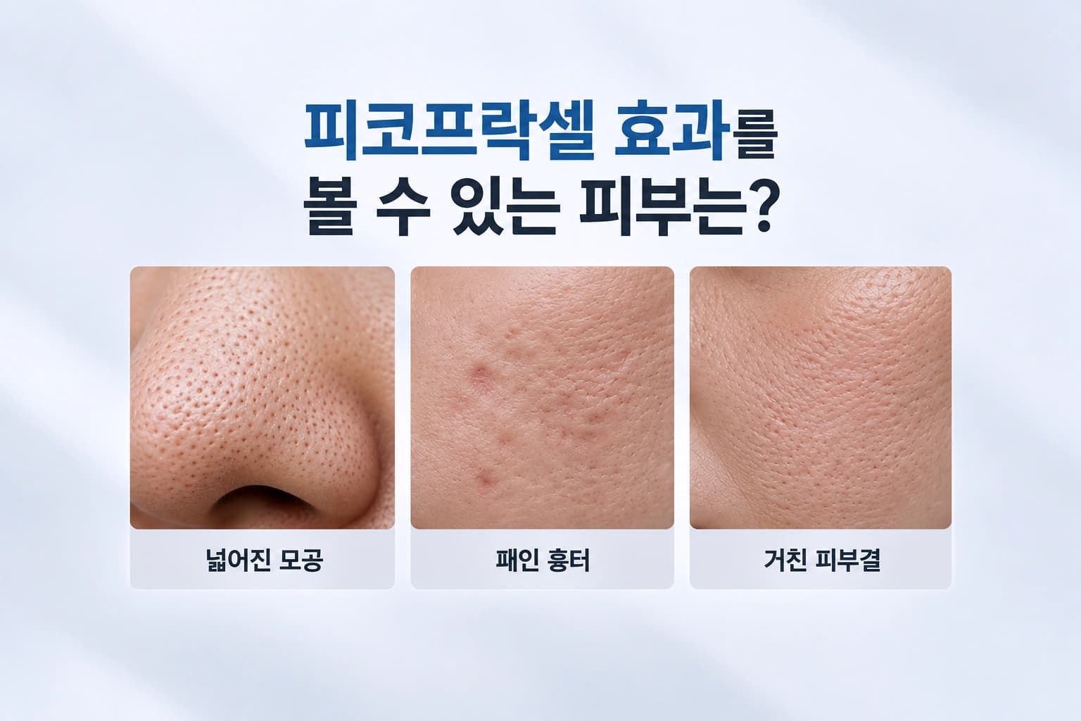 피코프락셀 효과를 볼 수 있는 넓어진 모공·패인 흉터·거친 피부결 유형